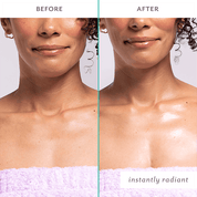 FIRM BELIEVER NECK TREATMENT by PATCHOLOGY