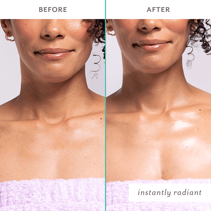 FIRM BELIEVER NECK TREATMENT by PATCHOLOGY