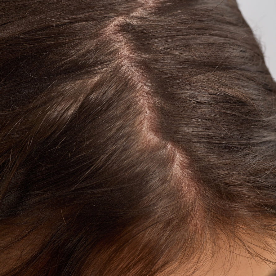 HAIR & SCALP OIL by KITSCH