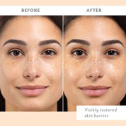 SKIN REMEDY 4 PACK by PATCHOLOGY