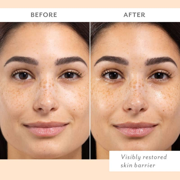 SKIN REMEDY 4 PACK by PATCHOLOGY